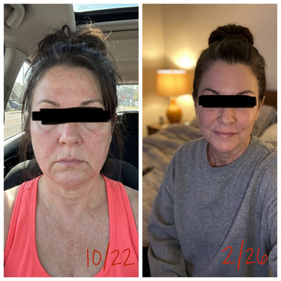 2. Inflamed, Stressed-Looking Skin