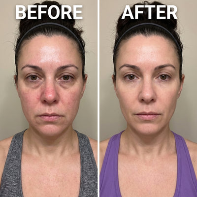 Frankincense Castor Oil Roller 100% Organic