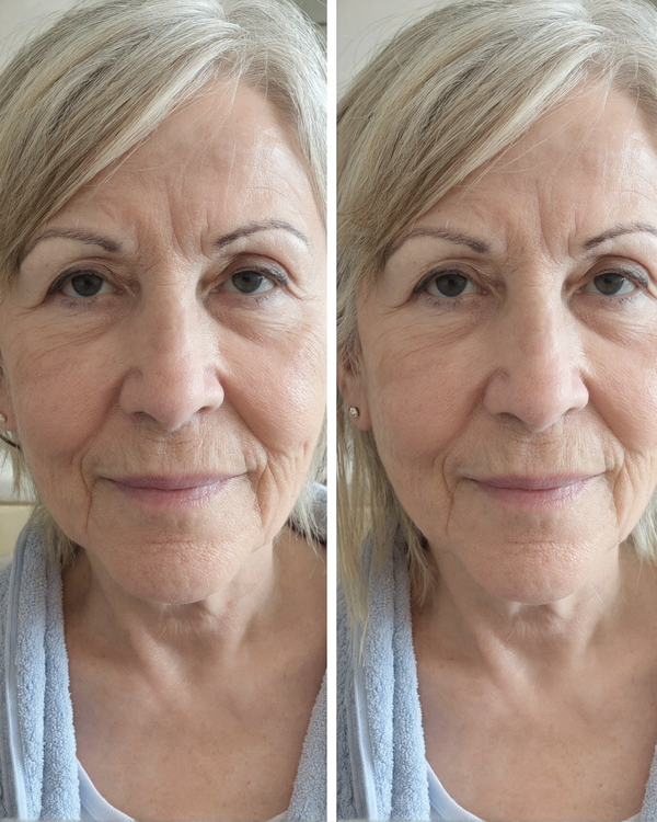 Customer result